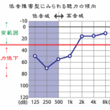 豊田市低音難聴の治療