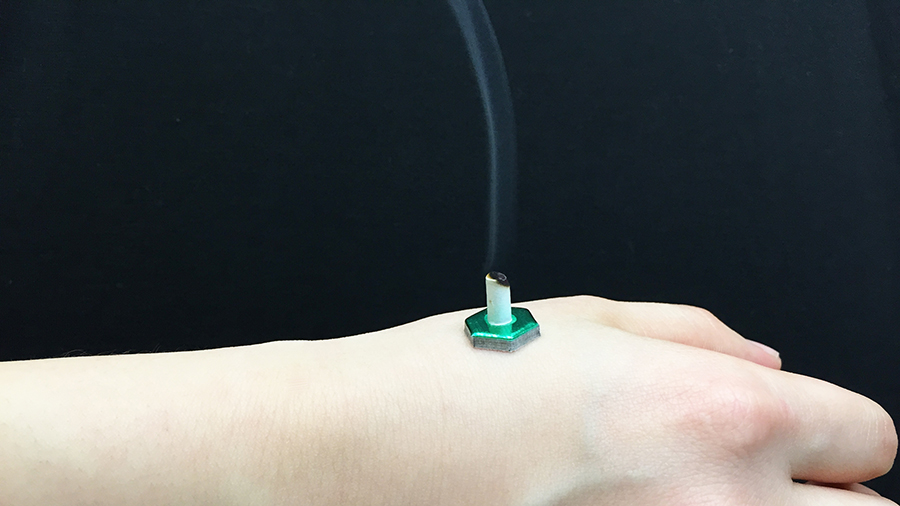 腱鞘炎の治療