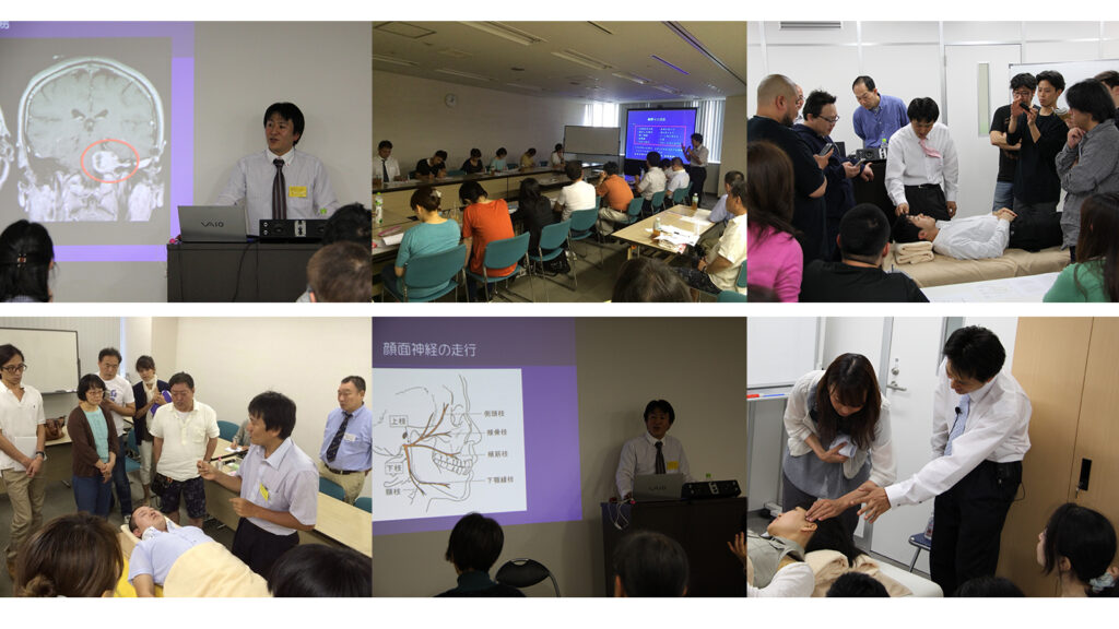 顔面神経麻痺に対する鍼灸治療勉強会