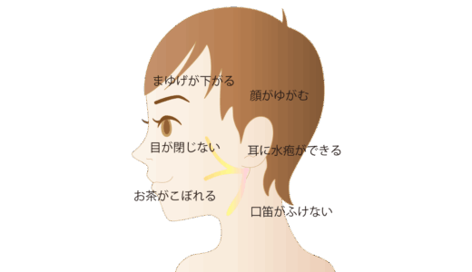 顔面神経麻痺とその治療についてQ&A