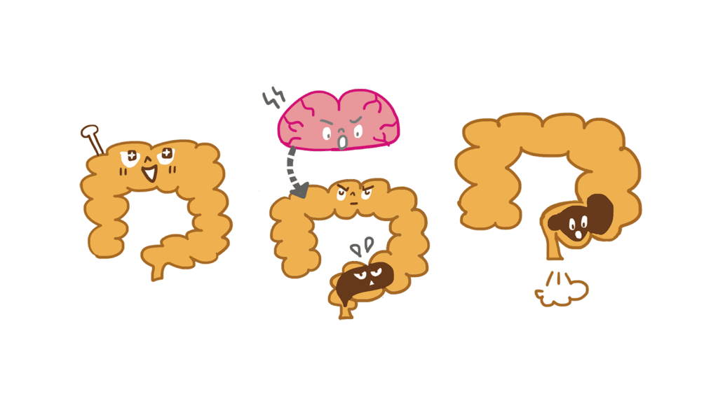 豊田市子供の便秘外来